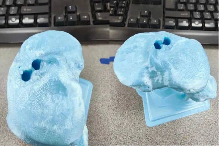 長沙市中醫(yī)院應(yīng)用3D打印技術(shù)制作百余例模型，助力精準(zhǔn)醫(yī)療